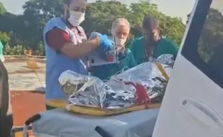 Imagem ilustrativa da imagem Mulher é intubada após sofrer queimaduras com óleo quente no Norte do ES