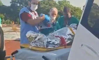 Imagem ilustrativa da imagem Mulher é intubada após sofrer queimaduras com óleo quente no Norte do ES
