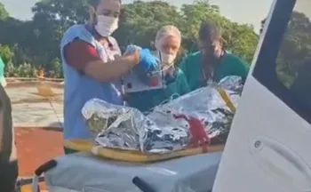 Imagem ilustrativa da imagem Mulher é intubada após sofrer queimaduras com óleo quente no Norte do ES