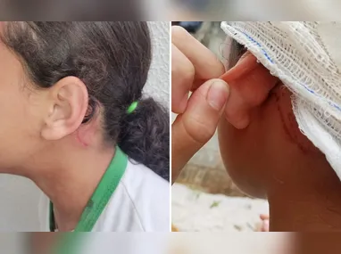 A vítima foi identificada como Ravi Maia Pantaleão, de 3 anos