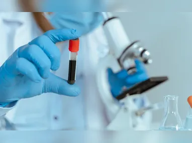 Neide Boldrini destaca que o exame de DNA-HPV é feito por meio da biologia molecular e é mais eficaz