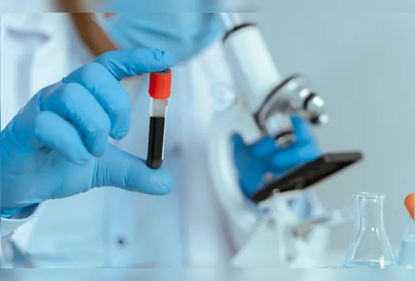 Imagem ilustrativa da imagem Novo exame para diagnosticar Alzheimer chega ao país