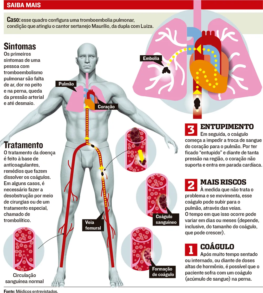 Imagem ilustrativa da imagem Dor na perna é sinal de doença que afetou Maurílio