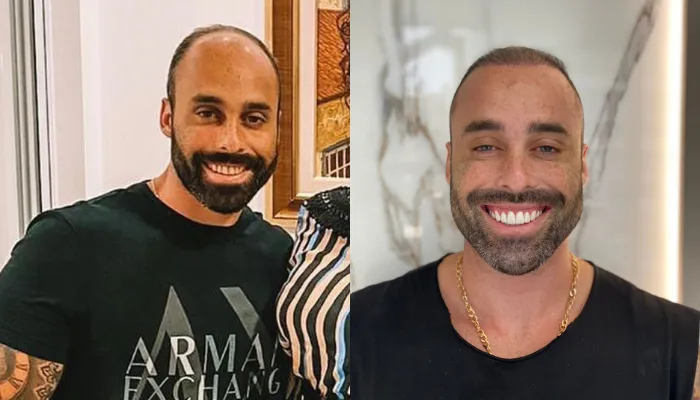 Imagem ilustrativa da imagem Homens procuram especialistas para mudar formato do rosto