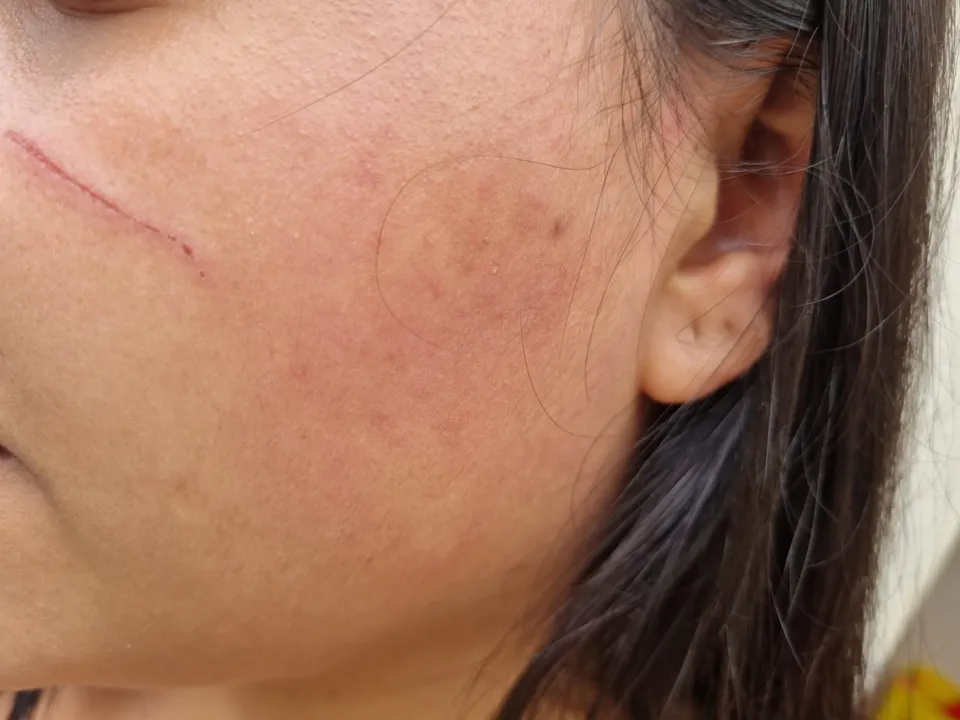 Imagem ilustrativa da imagem Jovem é agredida e trancada em casa com os filhos pelo ex-marido