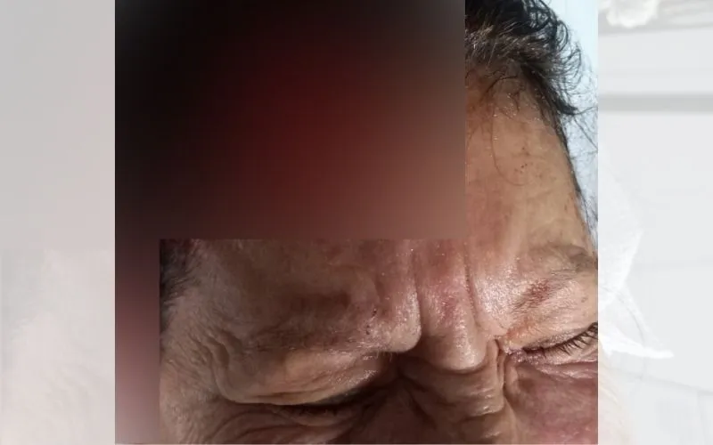 Imagem ilustrativa da imagem Aposentada atacada por pitbulls em Vila Velha continua em hospital