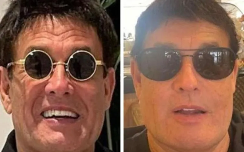 Imagem ilustrativa da imagem Idosos recorrem à harmonização facial