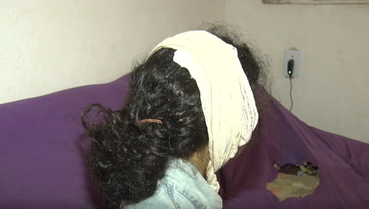 Imagem ilustrativa da imagem Menina de 8 anos é vítima de bala perdida em Cariacica