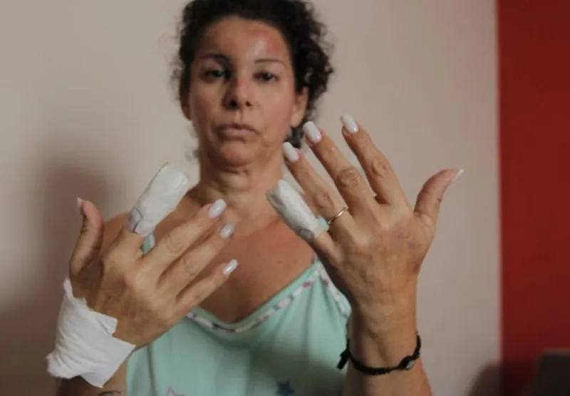Manicure é agredida com cadeiradas, socos e chutes após bater carro do marido
