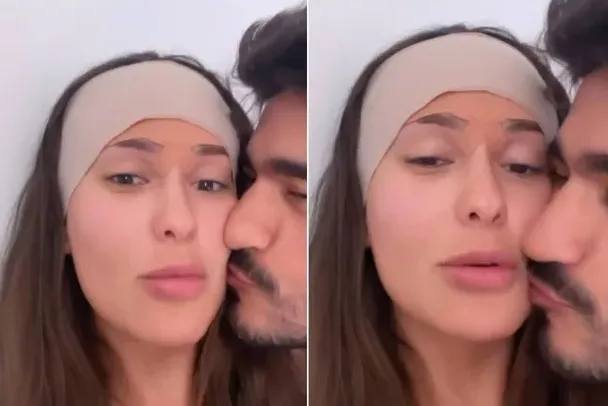 Imagem ilustrativa da imagem Ex-BBB Thais faz cirurgia para reduzir o tamanho da testa