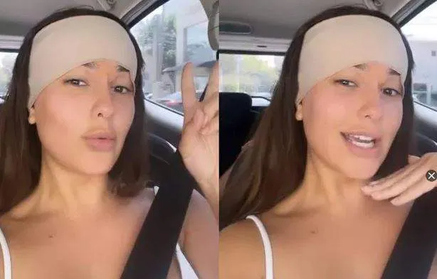 Imagem ilustrativa da imagem Ex-BBB Thais faz cirurgia para reduzir o tamanho da testa