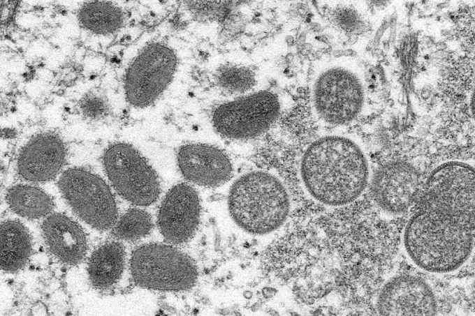 Imagem do vírus da varíola