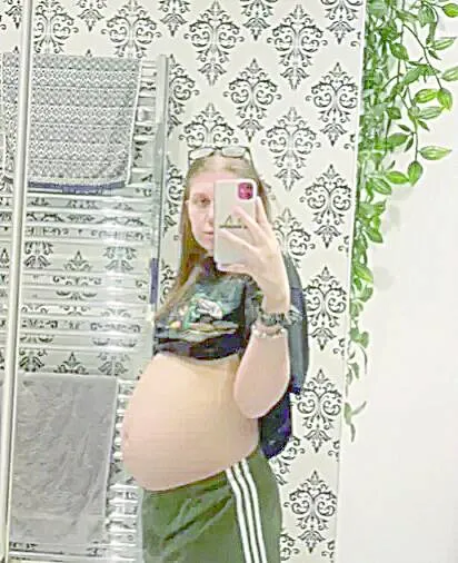 Imagem ilustrativa da imagem Mulher descobre que barriga de gravidez era cisto gigante