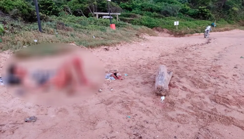 Imagem ilustrativa da imagem Jovem que teve a barriga aberta em Guarapari volta a ser internado