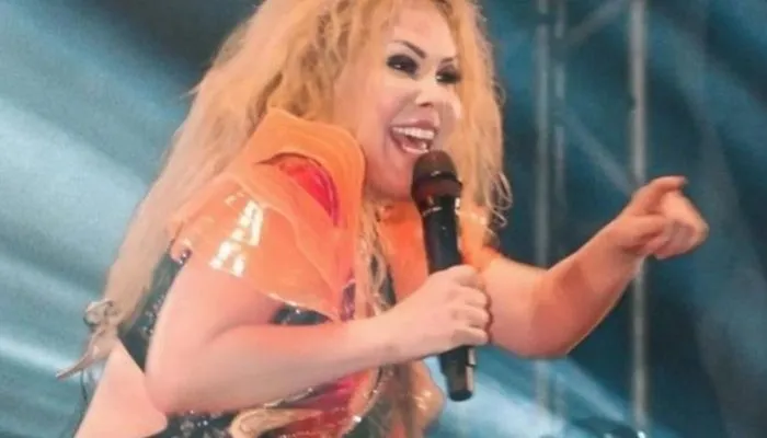 Imagem ilustrativa da imagem Fãs se assustam após Joelma aparecer com rosto inchado em show