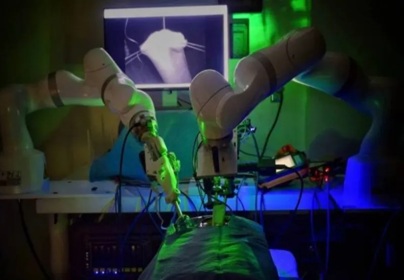 Robô realiza cirurgia sem ajuda humana.