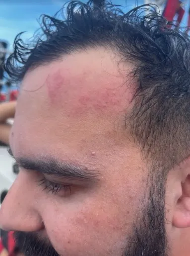 Imagem ilustrativa da imagem VÍDEO | Casal capixaba cai de paraquedas durante passeio em praia na Colômbia