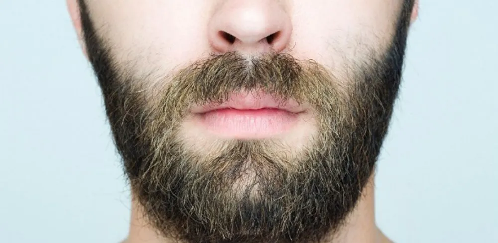 Imagem ilustrativa da imagem Homens recorrem a transplante de barba