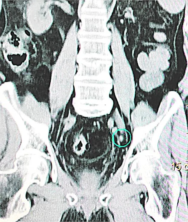 Imagem ilustrativa da imagem Medicina nuclear no combate ao câncer