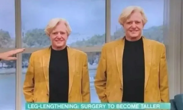 Imagem ilustrativa da imagem Homem gasta R$ 800 mil para ficar mais alto. Veja antes e depois