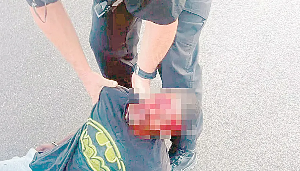 Imagem ilustrativa da imagem Polícia espanca homem negro que avançou sinal vermelho