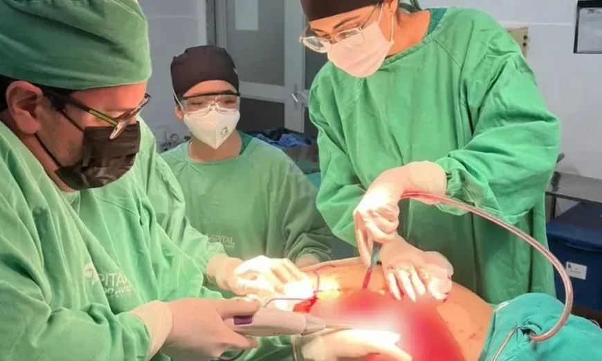 Imagem ilustrativa da imagem Biópsia aponta que tumor de 46kg retirado de mulher teve origem no útero