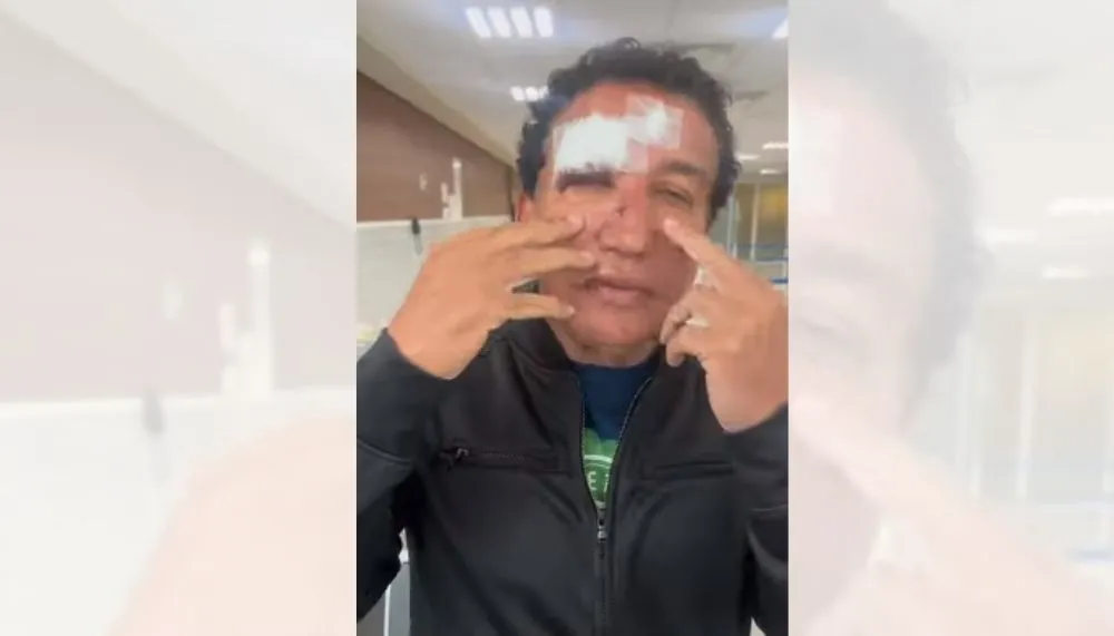 Imagem ilustrativa da imagem Magno Malta aparece machucado e diz que sofreu acidente em hotel