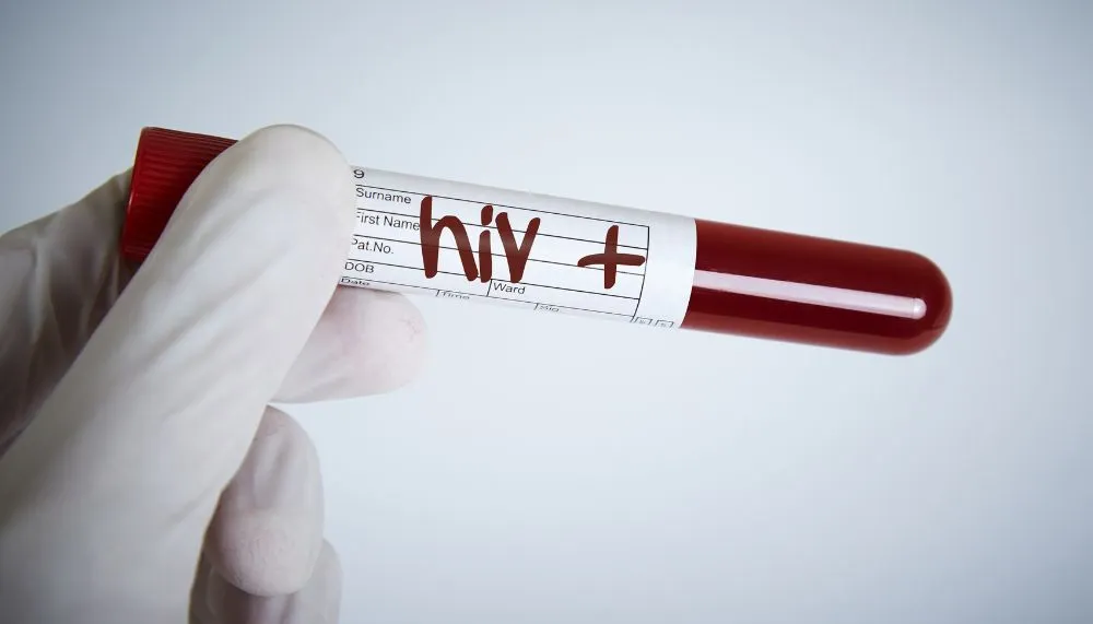 Imagem ilustrativa da imagem Preso empresário suspeito de transmitir HIV de propósito a mulheres