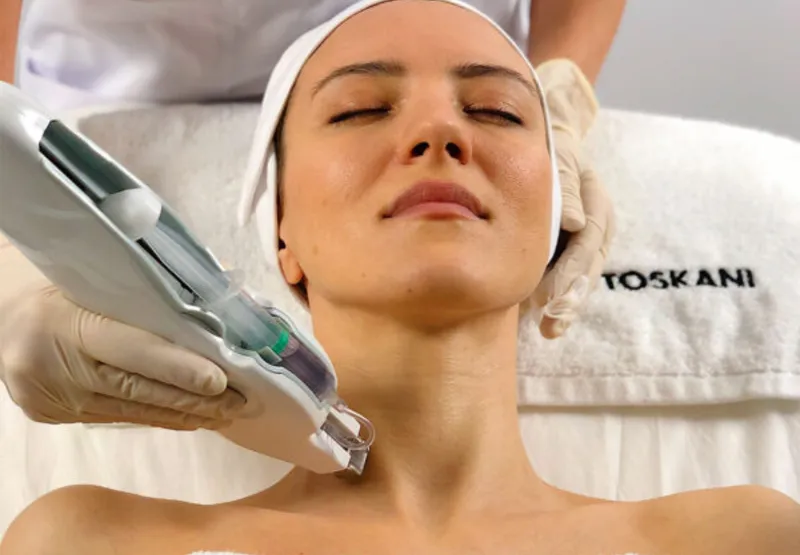 EQUIPAMENTO proporciona um método indolor para tratamentos faciais, corporais e também capilares