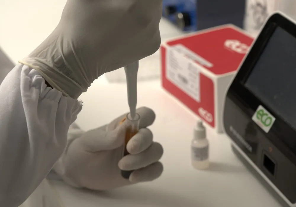 Imagem ilustrativa da imagem Testes rápidos para detectar dengue em até um dia no ES