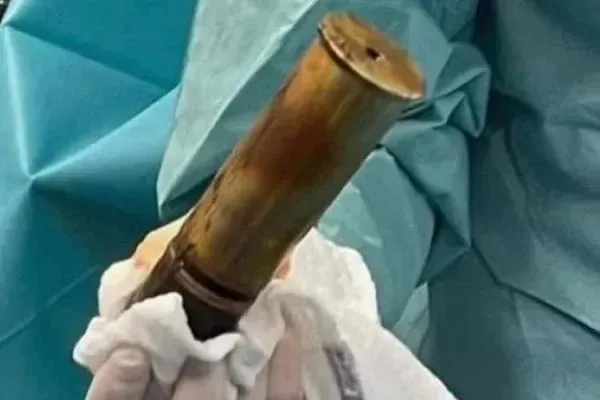 Imagem ilustrativa da imagem Idoso faz hospital ser evacuado ao chegar com bomba presa nas partes íntimas