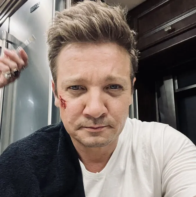 Imagem ilustrativa da imagem Jeremy Renner recebe alta após acidente grave