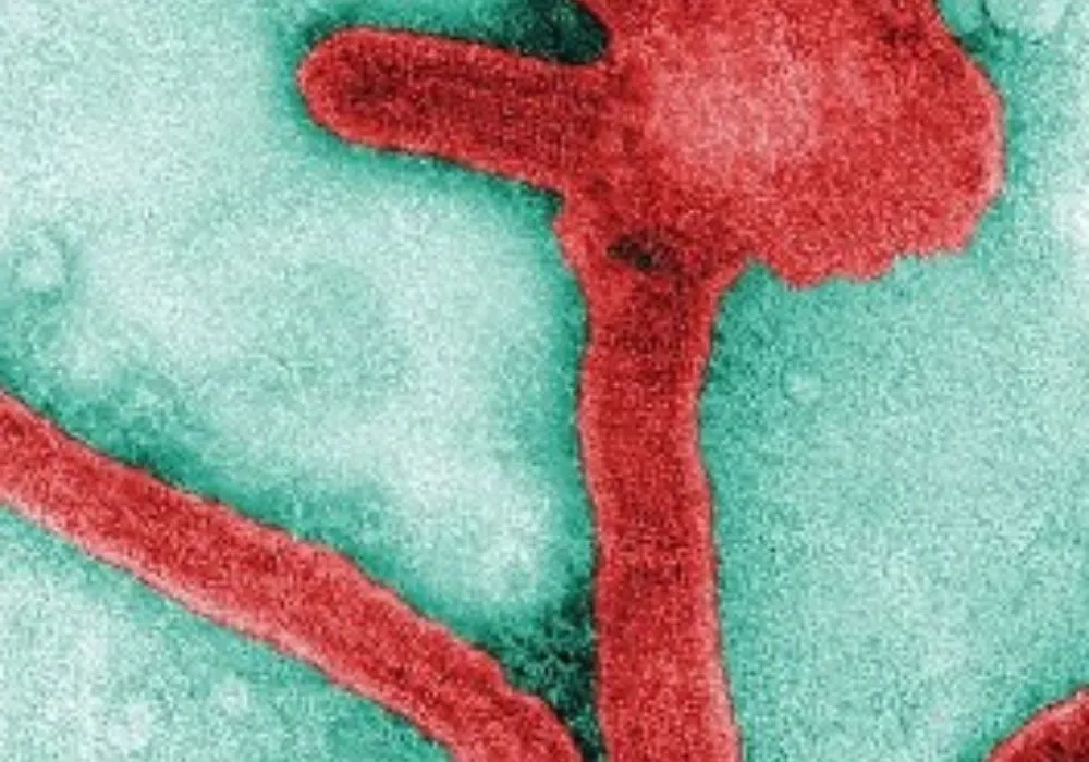 Imagem ilustrativa da imagem Tanzânia confirma surto do vírus Marburg, de grande letalidade