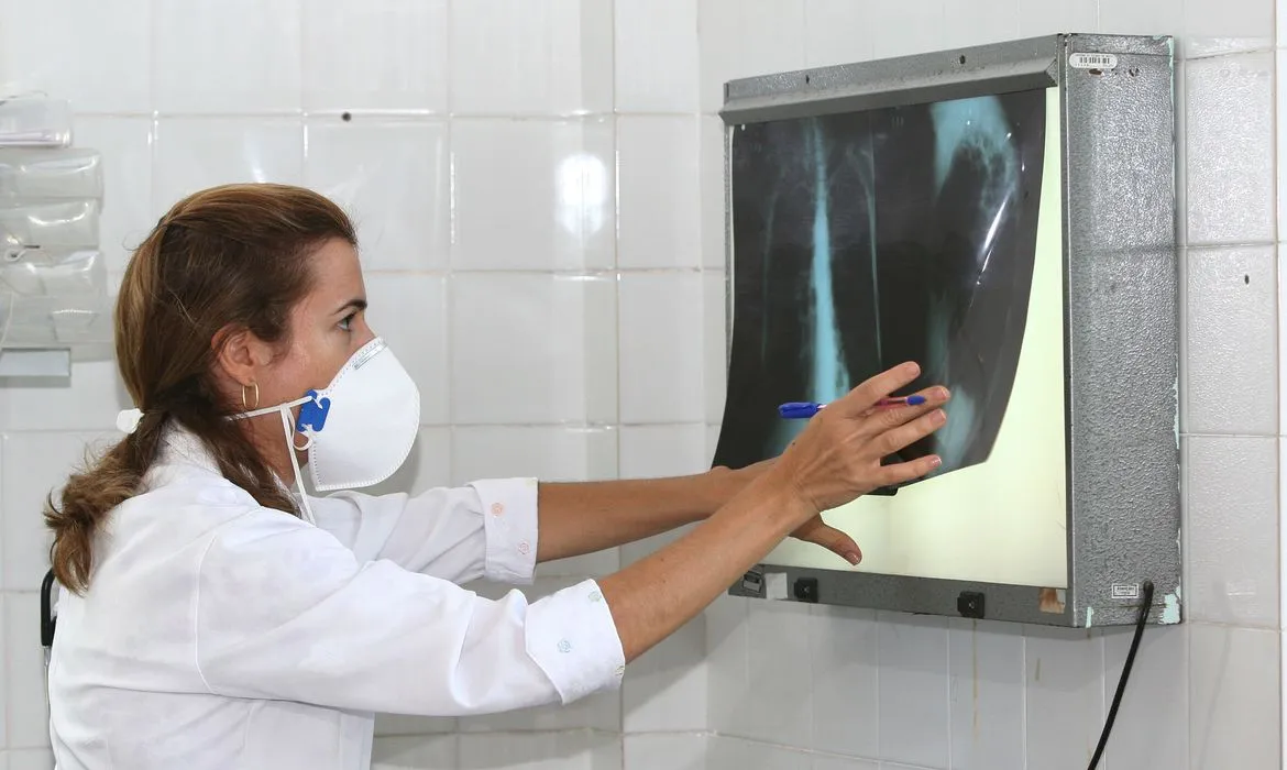 Imagem ilustrativa da imagem Brasil registra 78 mil novos casos de tuberculose