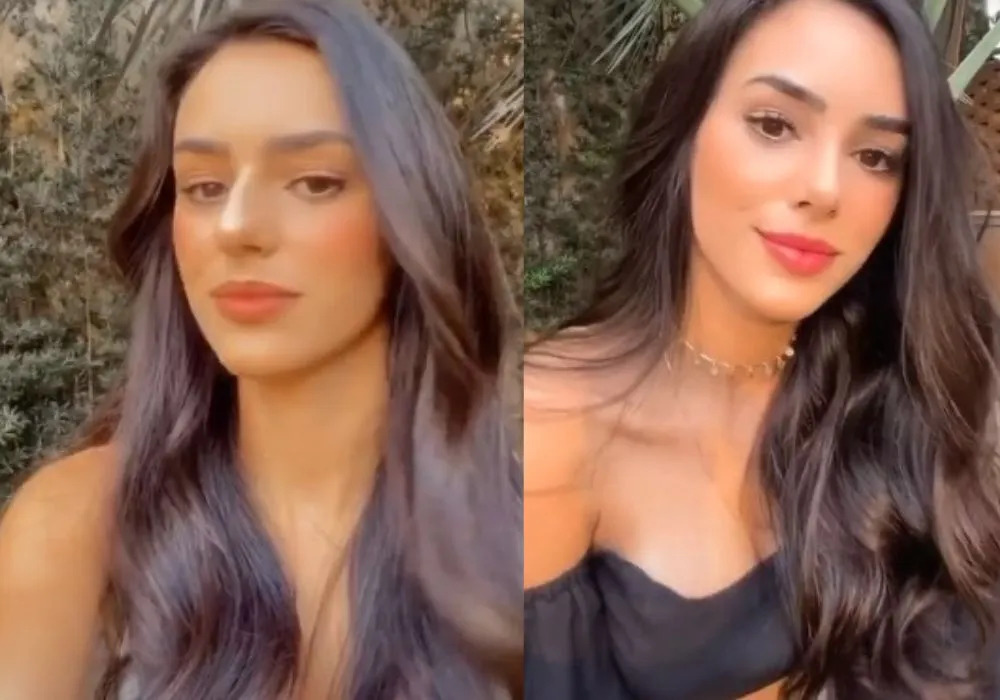 Imagem ilustrativa da imagem Namorada de Neymar mostra antes e depois de cirurgia plástica e web reage