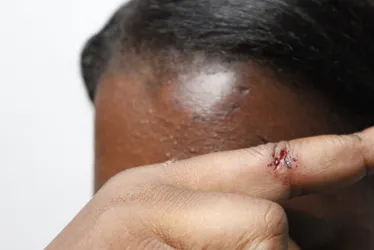 Imagem ilustrativa da imagem Mulher é mordida e arrastada com carro pelo ex-marido em Cariacica