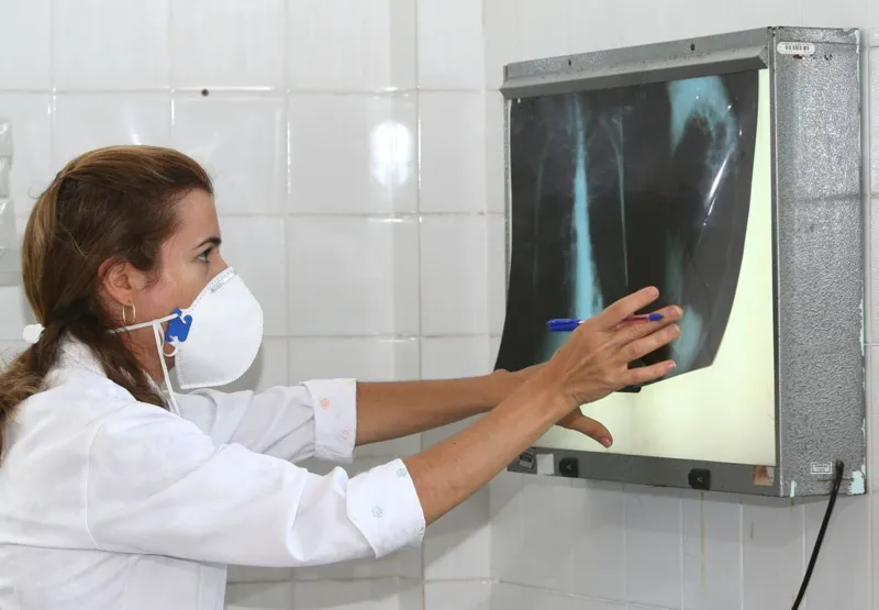 Brasil teve recorde de mortes por tuberculose
