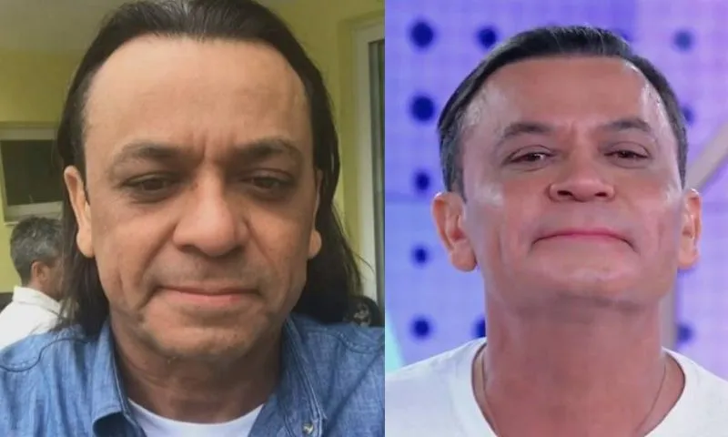 Imagem ilustrativa da imagem Frank Aguiar se compara com Brad Pitt após harmonização facial