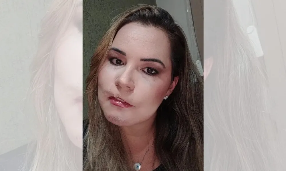Imagem ilustrativa da imagem “Injeções da beleza” podem matar, alertam médicos
