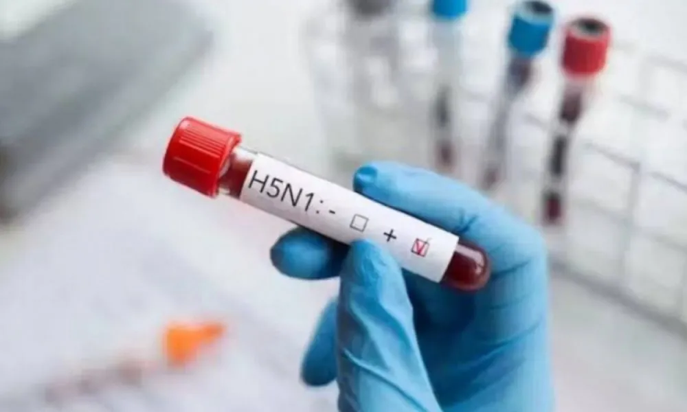 Imagem ilustrativa da imagem Rio de Janeiro registra terceiro caso de gripe aviária