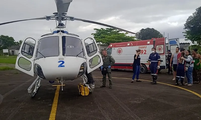 Imagem ilustrativa da imagem Menino tem parte do corpo queimado e precisa ser resgatado de helicóptero no ES