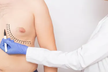 Imagem ilustrativa da imagem 4.100 homens buscam cirurgia para reduzir mama