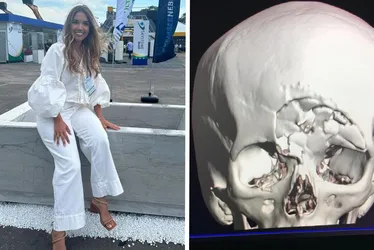 Imagem ilustrativa da imagem Advogada ferida com pedra vai passar por nova cirurgia