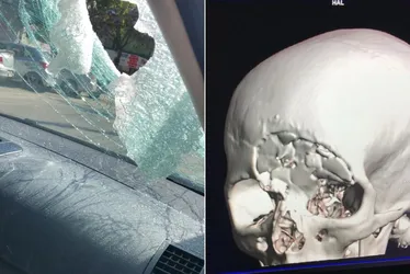 Imagem ilustrativa da imagem Advogada fratura a cabeça após levar pedrada dentro de carro na Rodovia do Sol