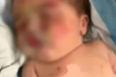 Imagem ilustrativa da imagem Bebê abandonada é encontrada em sacola carregada por cachorro no Líbano
