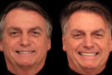 Imagem ilustrativa da imagem Bolsonaro põe lentes nos dentes e diz que vaidade não faz mal