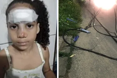Imagem ilustrativa da imagem Criança é arremessada para o alto após ser atingida por fiação na Serra