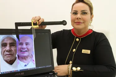 Imagem ilustrativa da imagem Especialistas explicam limites da harmonização