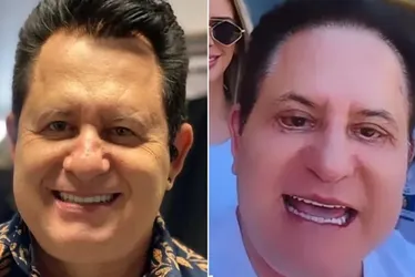 Imagem ilustrativa da imagem Especialistas explicam limites da harmonização