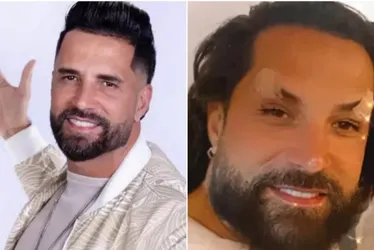 Imagem ilustrativa da imagem Especialistas explicam limites da harmonização